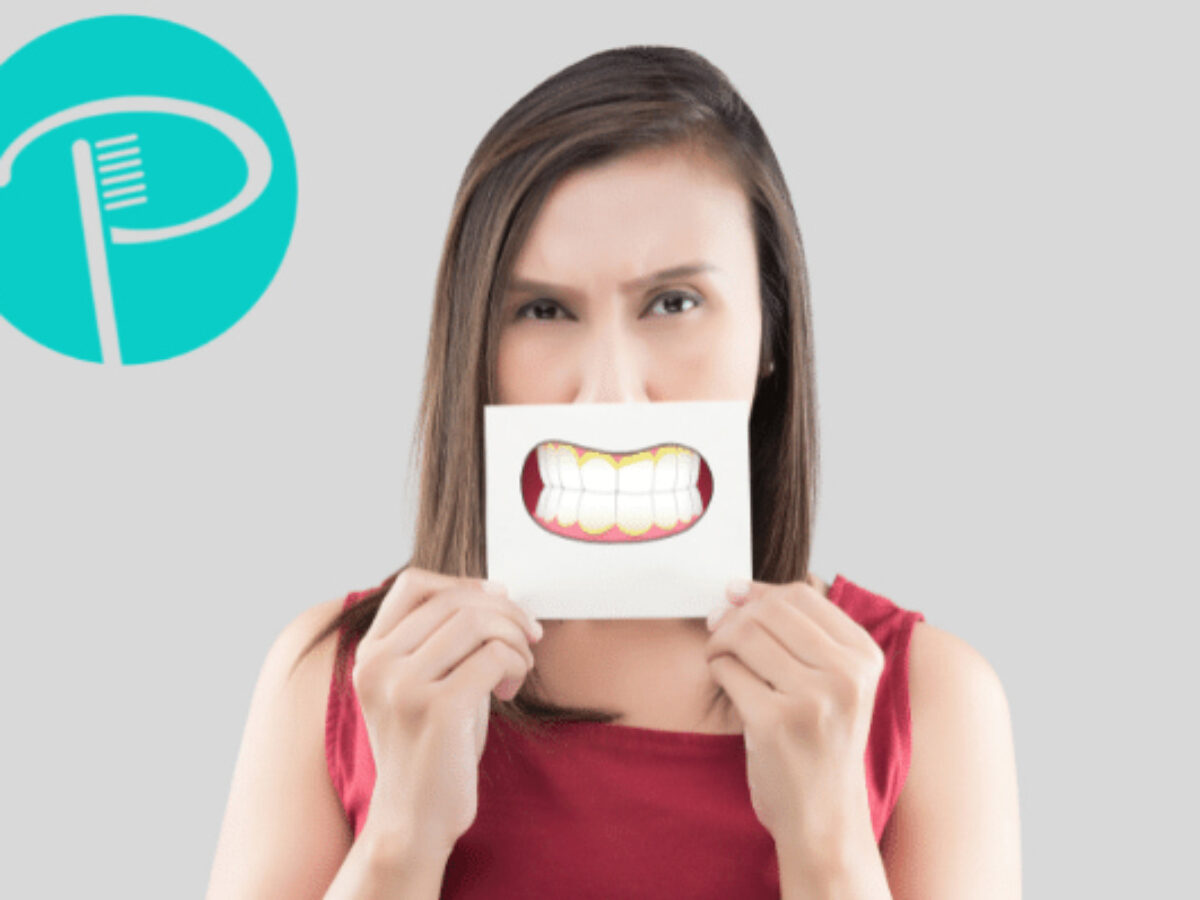 Complete guide to Tooth Plaque and Dental Tartar - Southland
